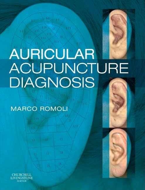 Auricular Acupuncture Diagnosis,Used