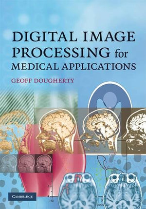 Digital Image Processing For Medical Applications,New