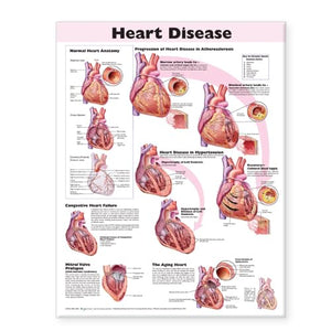 Heart Disease Anatomical Chart,New