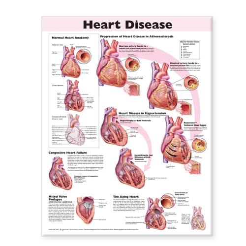 Heart Disease Anatomical Chart,New