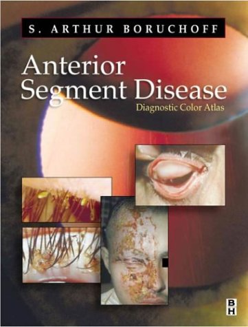 Anterior Segment Disorder: A Diagnostic Color Atlas,Used