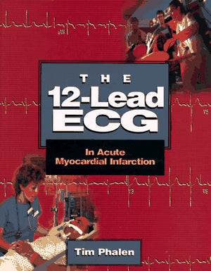 The 12Lead Ecg: In Acute Myocardial Infarction,New