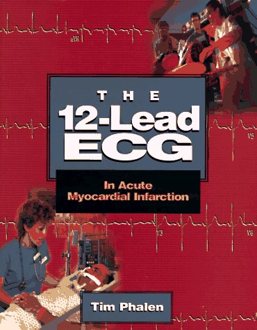 The 12Lead Ecg: In Acute Myocardial Infarction,New