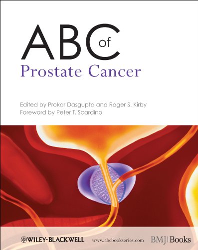 ABC of Prostate Cancer,Used