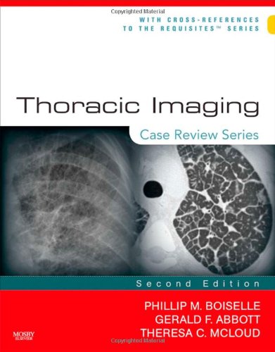 Thoracic Imaging: Case Review Series,Used