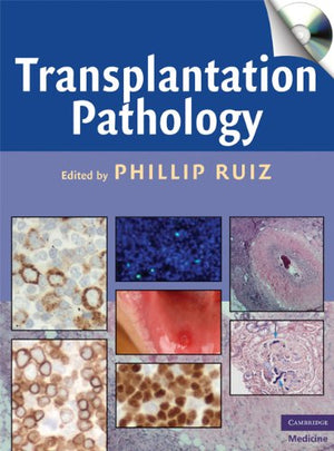 Transplantation Pathology,Used
