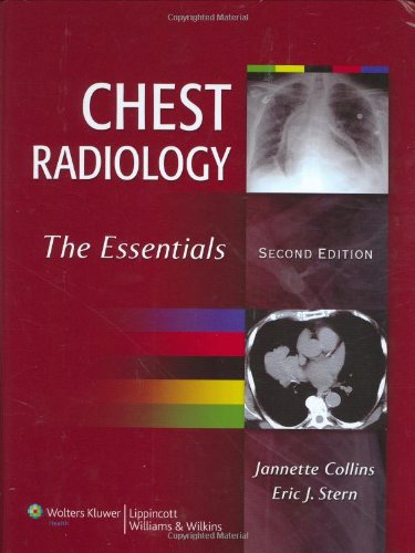Chest Radiology: The Essentials,Used