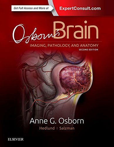 Osborn'S Brain