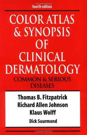 Color Atlas & Synopsis of Clinical Dermatology,New