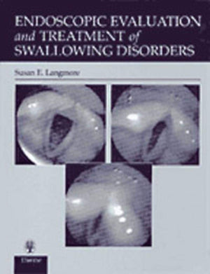 Endoscopic Evaluation and Treatment of Swallowing Disorders,Used