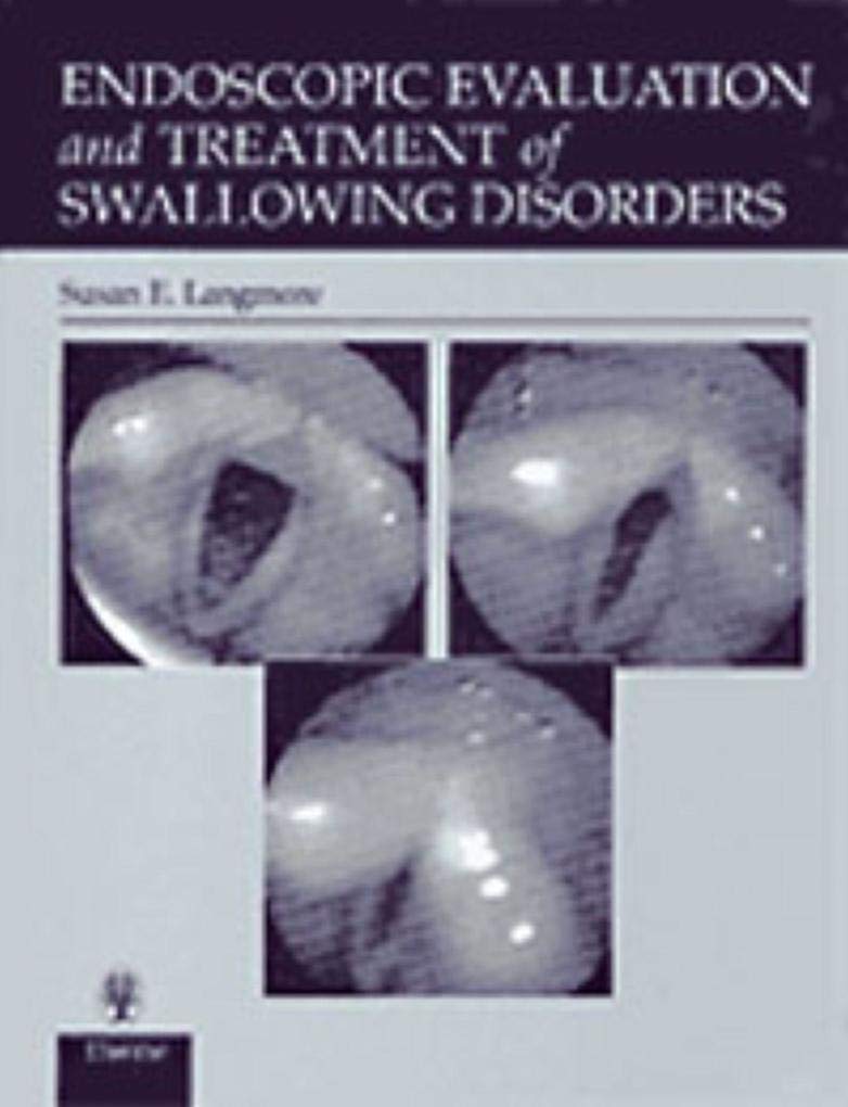 Endoscopic Evaluation and Treatment of Swallowing Disorders,Used