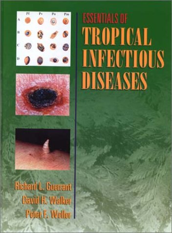 Essentials of Tropical Infectious Diseases,Used