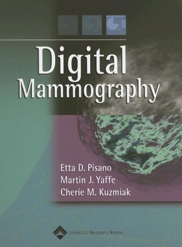 Digital Mammography,Used