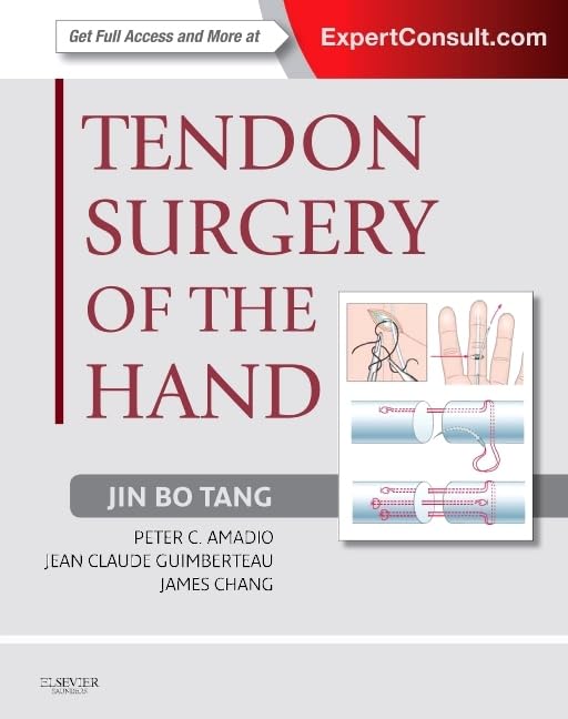 Tendon Surgery of the Hand,Used