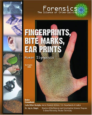 Fingerprints, Bite Marks, Ear Prints: Human Signposts (Forensics: the Science of Crimesolving),Used