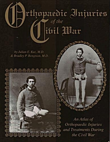 Orthopaedic Injuries Of The Civil War: An Atlas Of Orthopaedic Injuries And Treatments During The Civil War