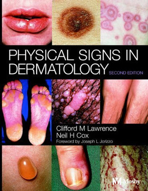 Physical Signs in Dermatology,Used