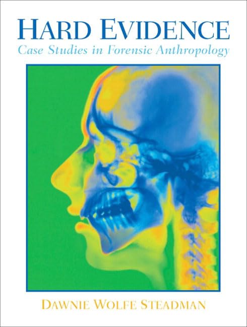 Hard Evidence: Case Studies in Forensic Anthropology,Used