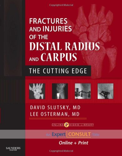 Fractures and Injuries of the Distal Radius and Carpus: The Cutting Edge  Expert Consult: Online and Print,Used