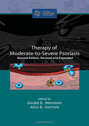 Therapy Of Moderatetoseverepsoriasis, Second Edition,Used