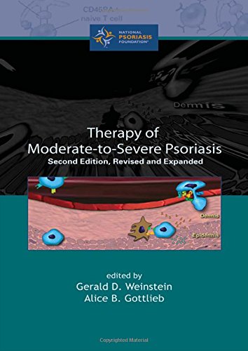 Therapy Of Moderatetoseverepsoriasis, Second Edition,Used