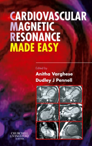 Cardiovascular Magnetic Resonance Made Easy,Used
