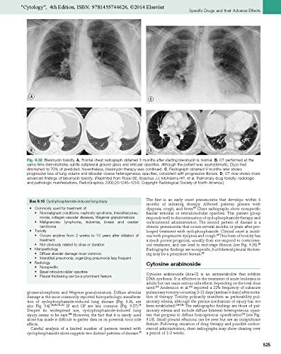 Imaging Of Diseases Of The Chest: Expert Consult  Online And Print