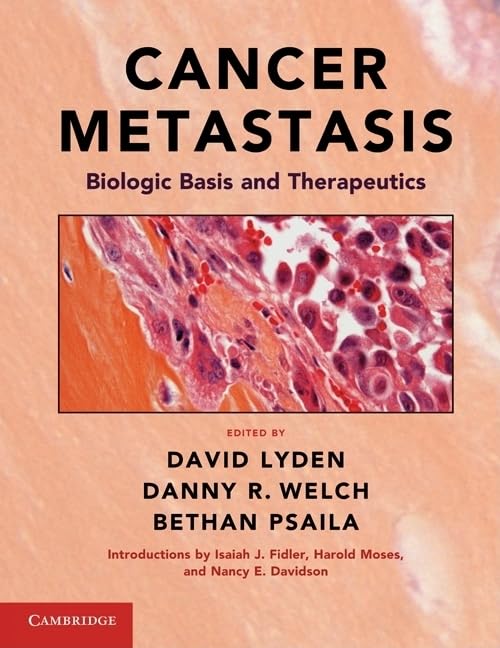 Cancer Metastasis: Biologic Basis and Therapeutics,Used