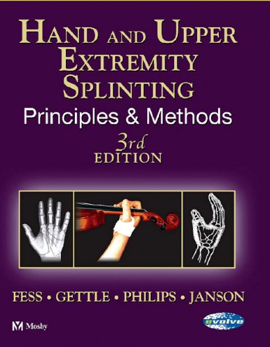 Hand and Upper Extremity Splinting: Principles and Methods,Used