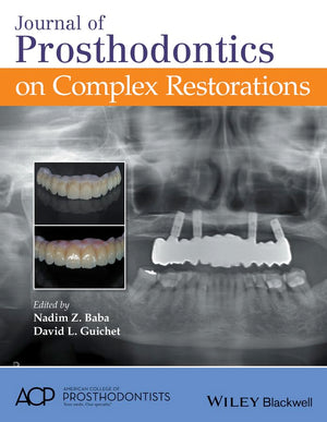 Journal of Prosthodontics on Complex Restorations,Used
