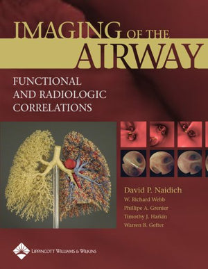 Imaging Of The Airways: Functional And Radiologic Correlations,Used
