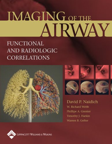 Imaging Of The Airways: Functional And Radiologic Correlations,Used