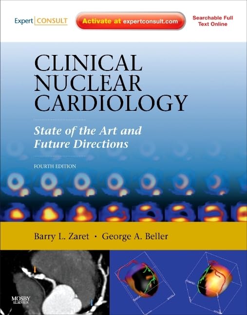 Clinical Nuclear Cardiology: State of the Art and Future Directions,Used