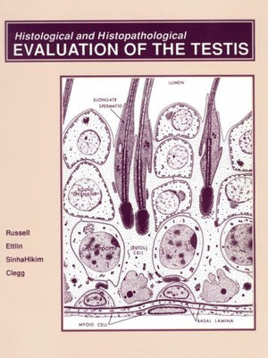 Histological and Histopathological Evaluation of the Testis,Used