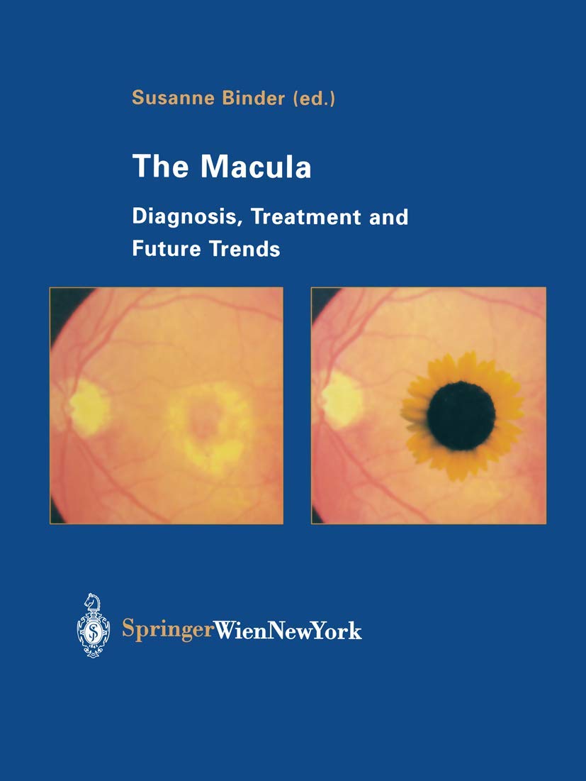 The Macula: Diagnosis, Treatment and Future Trends,Used