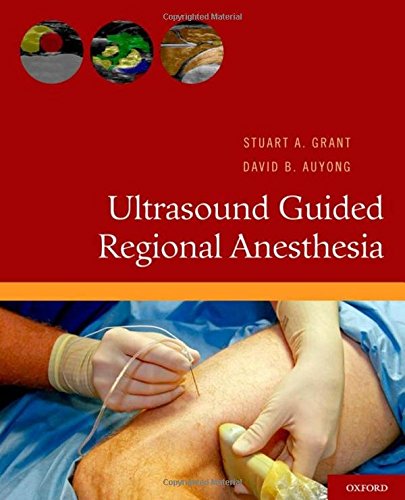 Ultrasound Guided Regional Anesthesia,Used