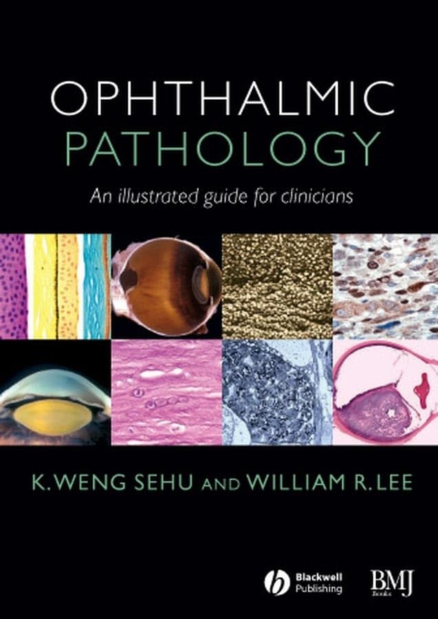 Ophthalmic Pathology: An Illustrated Guide For Clinicians-used