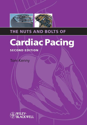 The Nuts and Bolts of Cardiac Pacing (Nuts and Bolts Series (Replaced by 5113)),Used