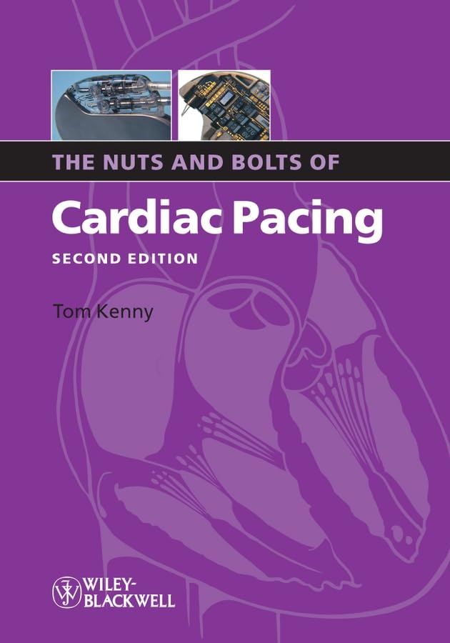 The Nuts and Bolts of Cardiac Pacing (Nuts and Bolts Series (Replaced by 5113)),Used