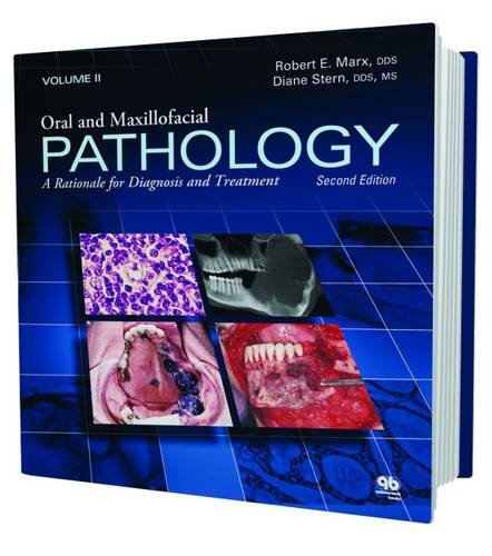 Oral and Maxillofacial Pathology: A Rationale for Diagnosis and Treatment,Used