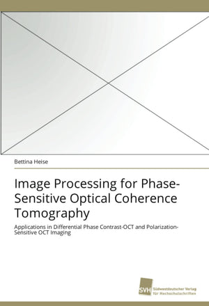 Image Processing for PhaseSensitive Optical Coherence Tomography: Applications in Differential Phase ContrastOCT and Polarizat,Used