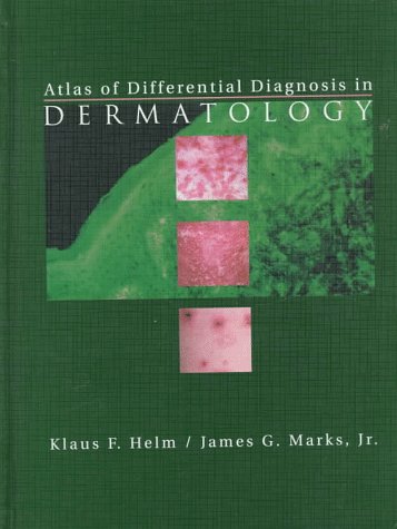 Atlas of Differential Diagnosis in Dermatology,Used