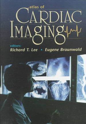 Atlas of Cardiac Imaging,Used