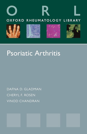 Psoriatic Arthritis (Oxford Rheumatology Library),Used