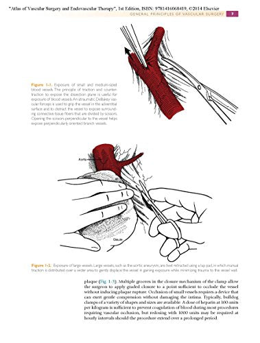 Atlas of Vascular Surgery and Endovascular Therapy,Used