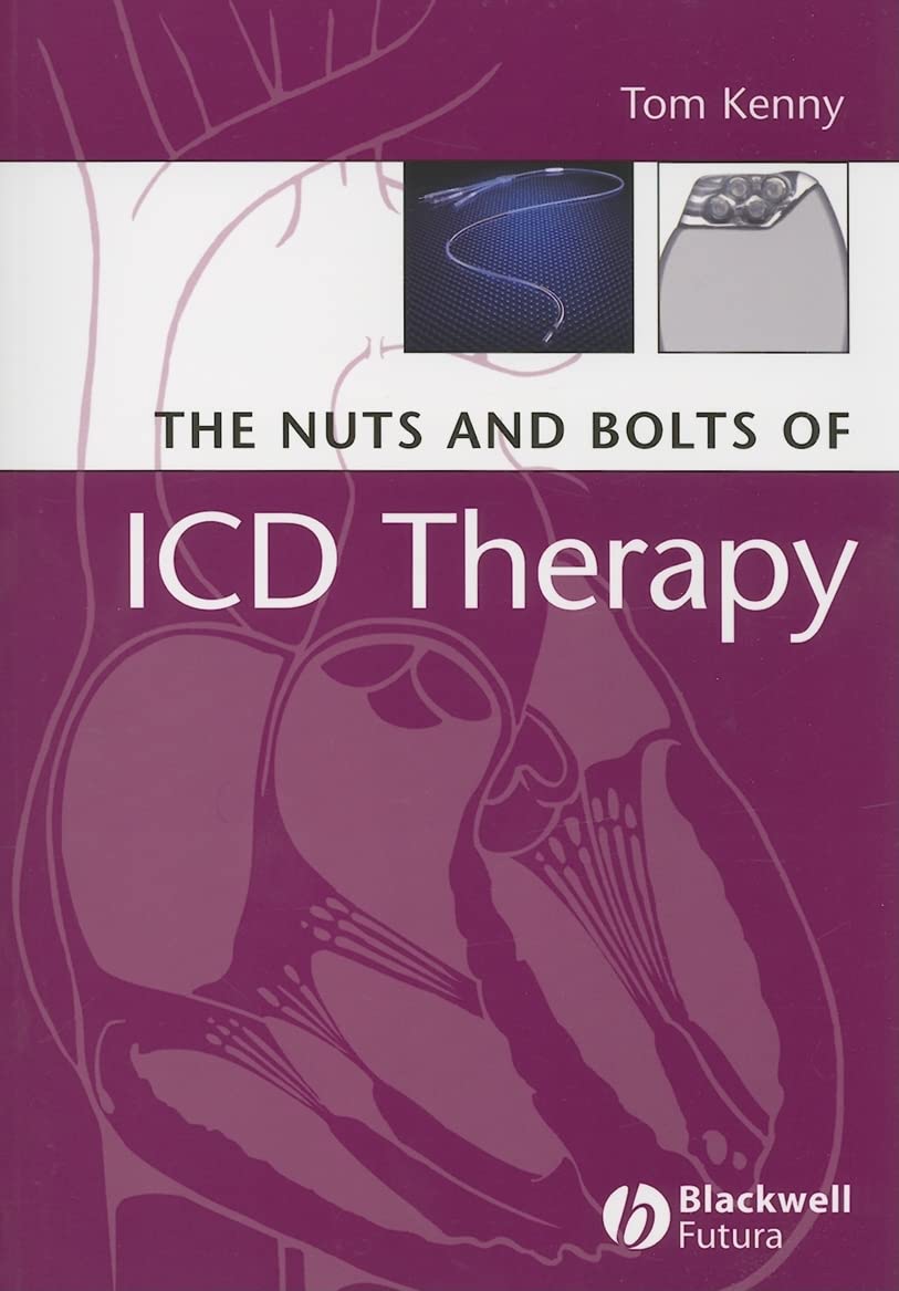 The Nuts and Bolts of ICD Therapy,Used