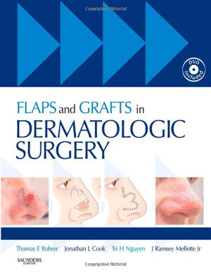 Flaps and Grafts in Dermatologic Surgery: Text with DVD,New