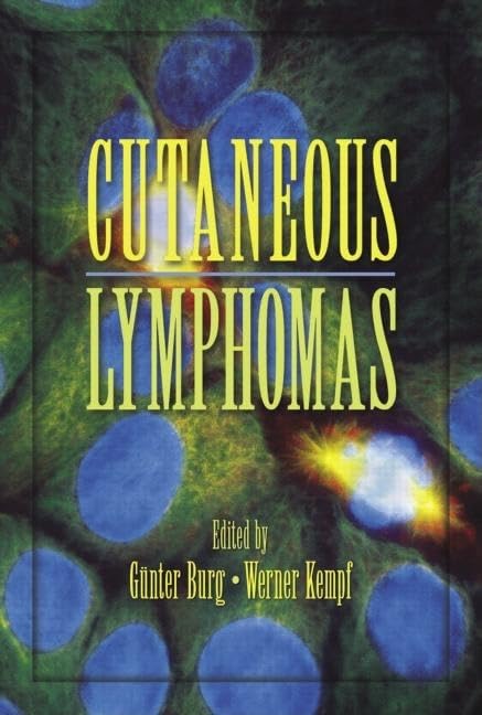 Cutaneous Lymphomas (Basic And Clinical Dermatology),Used