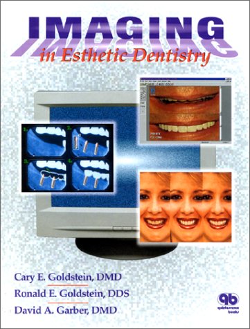 Imaging in Esthetic Dentistry,Used