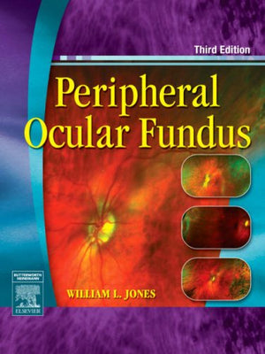 Peripheral Ocular Fundus,Used